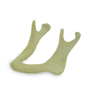 MANDÍBULA EDÊNTULA COM REABSORÇÃO ÓSSEA III - cód. 4010 AT - 03