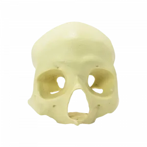 CRÂNIO FRONTAL All-on-4® ZIGOMA - cód. 9014