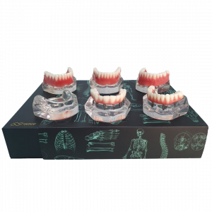 MESA CLÍNICA EM ACRÍLICO - cód. 9768