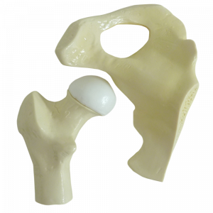 QUADRIL COM OSTEOARTRITE INÍCIO - cód. 9598-2