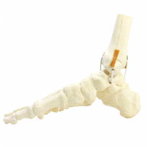 TORNOZELO DIREITO - FRATURA 1 - cód. 9699