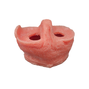 MENISCO MODELO ROSA (CORTE REDONDO) - cód. 6000-04