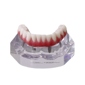 MANDÍBULA ACRÍLICA COM PROTOCOLO E 4 IMPLANTES - cód. 9568