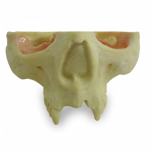 MAXILA COM AUSÊNCIA DOS DENTES 11/ 12/ 21 E 22 - cód. 9971 ST