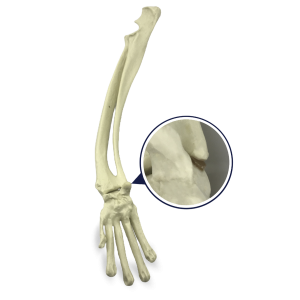 PUNHO DIREITO COM DEFORMIDADE - CÃO GRANDE PORTE - cód. AV726 D